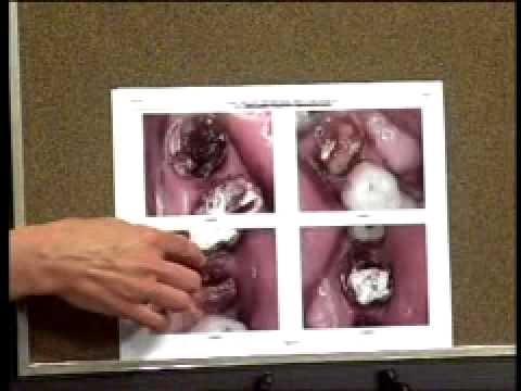 Ab Dental Mar 18_Sm.mov