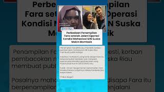 Penampilan Fara Uin Suska Disorot setelah Jalani Operasi, Disebut Beda saat Tanpa Make Up