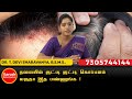 தலையில் குட்டி குட்டி கொப்பளம் வருதா