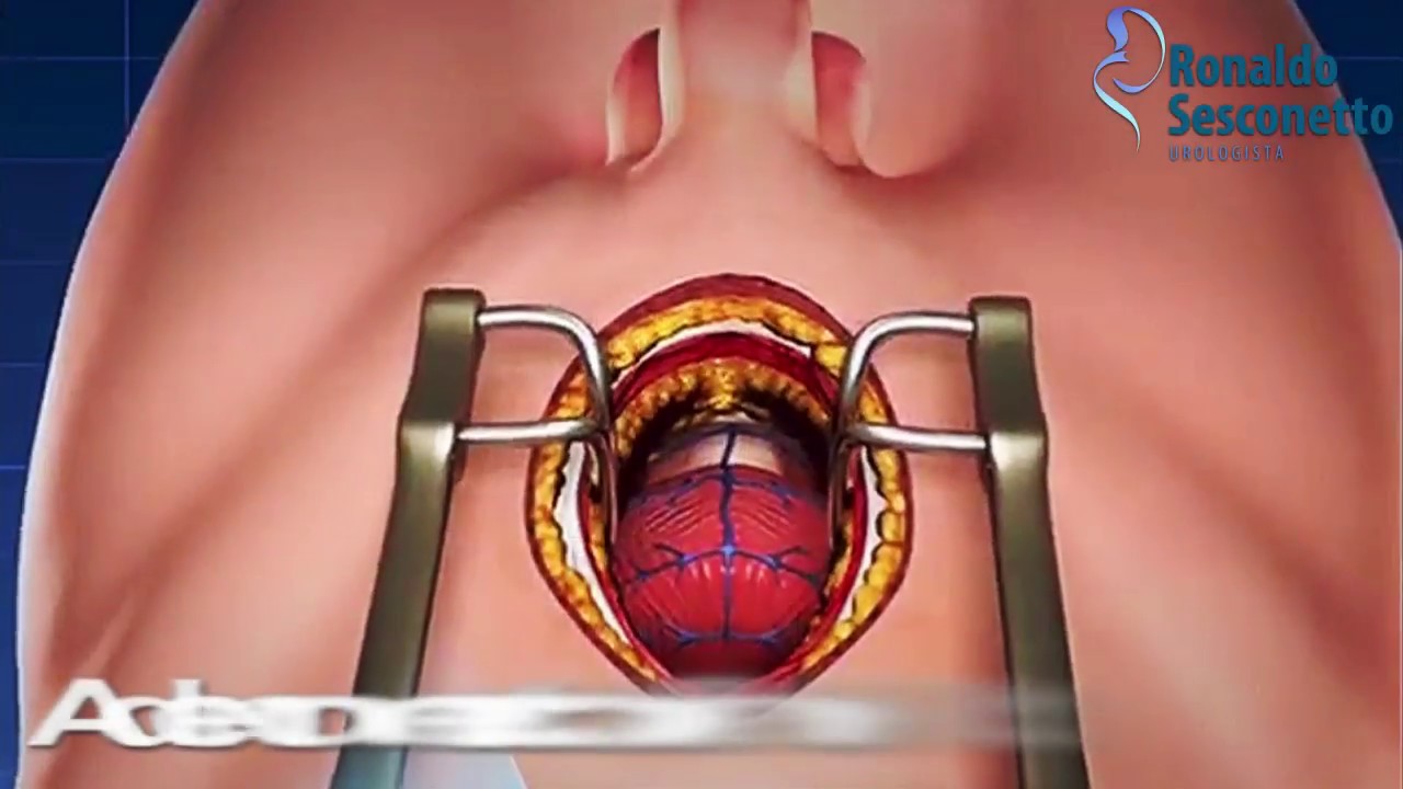Roberto Carlos Castañeda Caballero-16