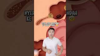Download lagu This is what is called appendicitis #appendicitis #healthtips #health #intestines #viral mp3 Download lagu This is what is called appendicitis #appendicitis #healthtips #health #intestines #viral mp3