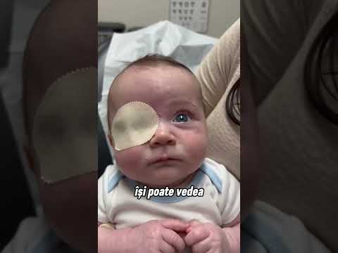Reacția bebelușului când i-a fost îndepărtat plasturele de pe ochi ♥️