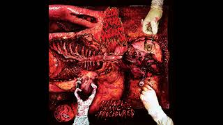 Cover art for Defiled Gestation