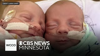 Minnesota woman gives birth to ultra rare mono mono twins