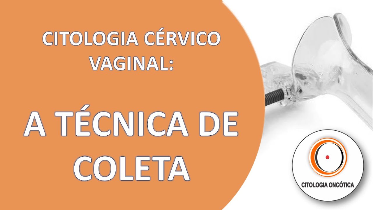 Citologia Cérvico Vaginal - A Técnica de Coleta