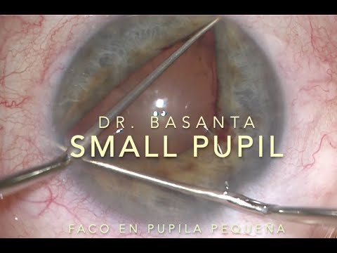 Small Pupil