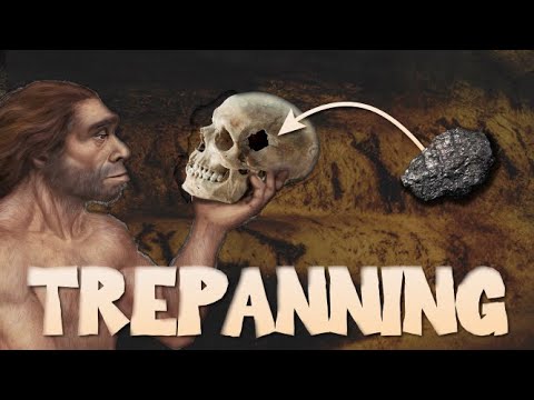 image-What is tretrepanning used for? 