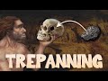 The History of Trepanning