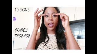 Ten signs and symptoms you have Graves Disease.