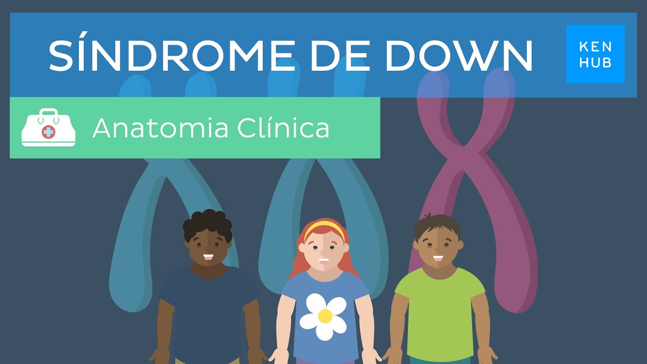 Síndrome de Down: Causas, características, diagnóstico e manejo | Kenhub