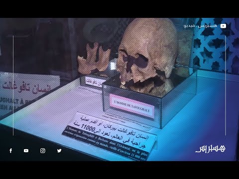 هيكل عظمي أول جراحة طبية في العالم لإنسان تافوغالت وأقدم جمجمة لديناصورعاشب معروضة للزوار في المغرب