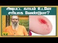 அடிபட்ட காயம் உடனே சரியாக வேண்டுமா Param