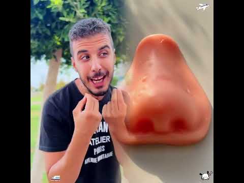 تبصش في حياة غيرك…👀😭❤️‍🩹فديو تمثيلي لنشر الخير بين الناس كريم حسنين