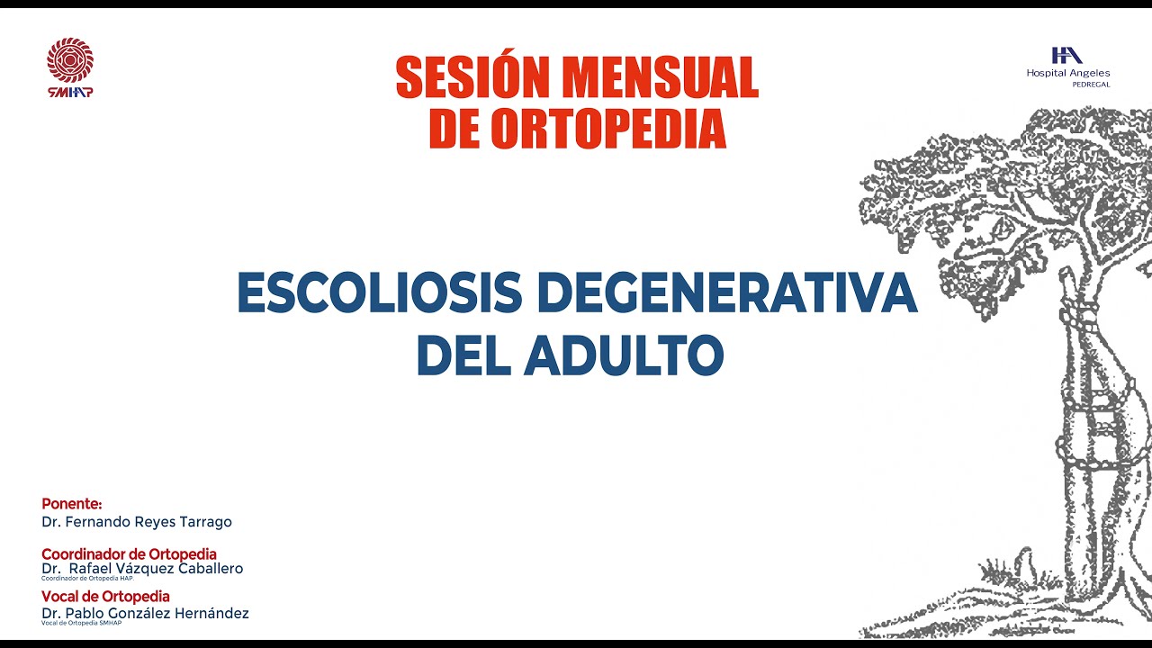 Fernando Reyes Tarrago-0