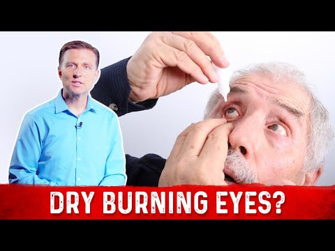 What Is Dry Burning Eyes & How To Get Rid Of Dry Eyes? – Dr.Berg