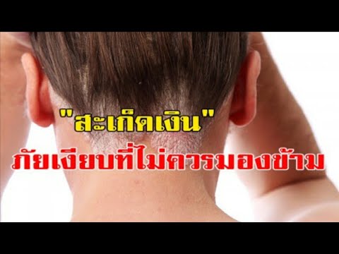 การดูแลผิวหลังโรคสะเก็ดเงิน ว่ามีเมล็ดในโรคสะเก็ดเงิน