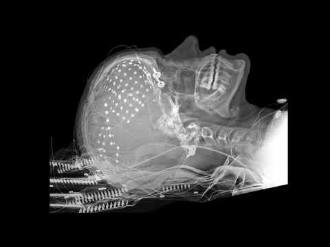 Bad Sector - Abnormal (cover of Death SS track)