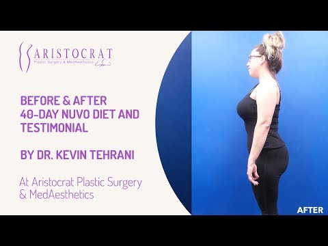 Before & After NUVO Diet Long Island, New York by Dr. Kevin Tehrani