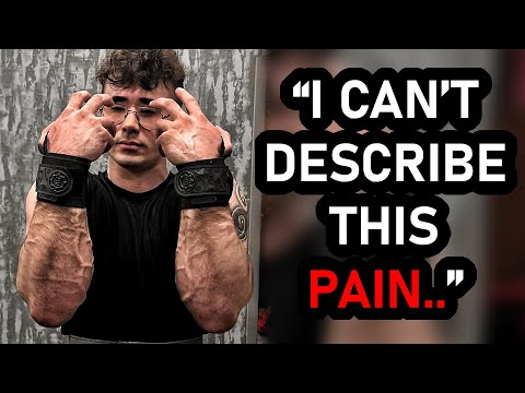 AKIMBO RAGES AT GVW ONCE AGAIN!