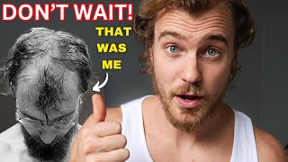 The 4 Balding Stages: WHAT TO DO BEFORE IT'S TOO LATE! (ultimate guide)