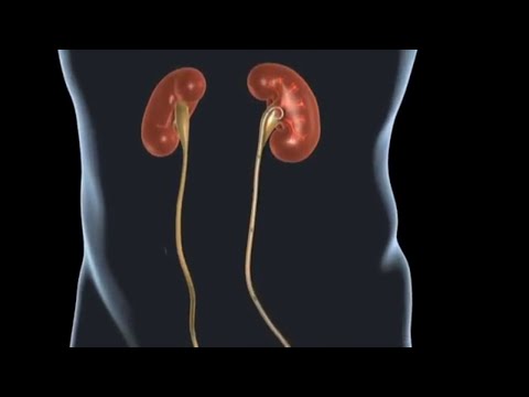 Treatment: Stent pain that can occur after kidney stone surgery.