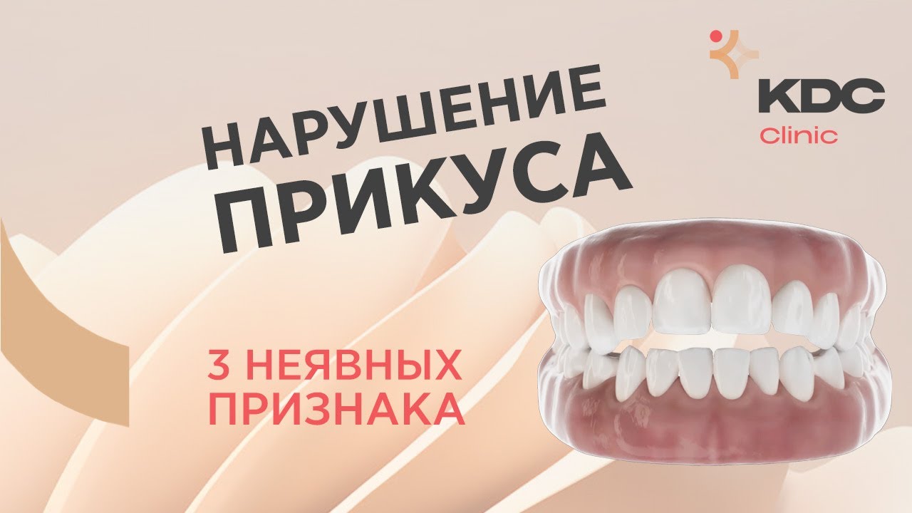 3 критерия идеального прикуса