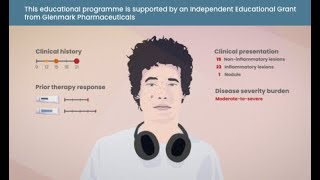 Improving acne vulgaris with multimodal treatment strategies