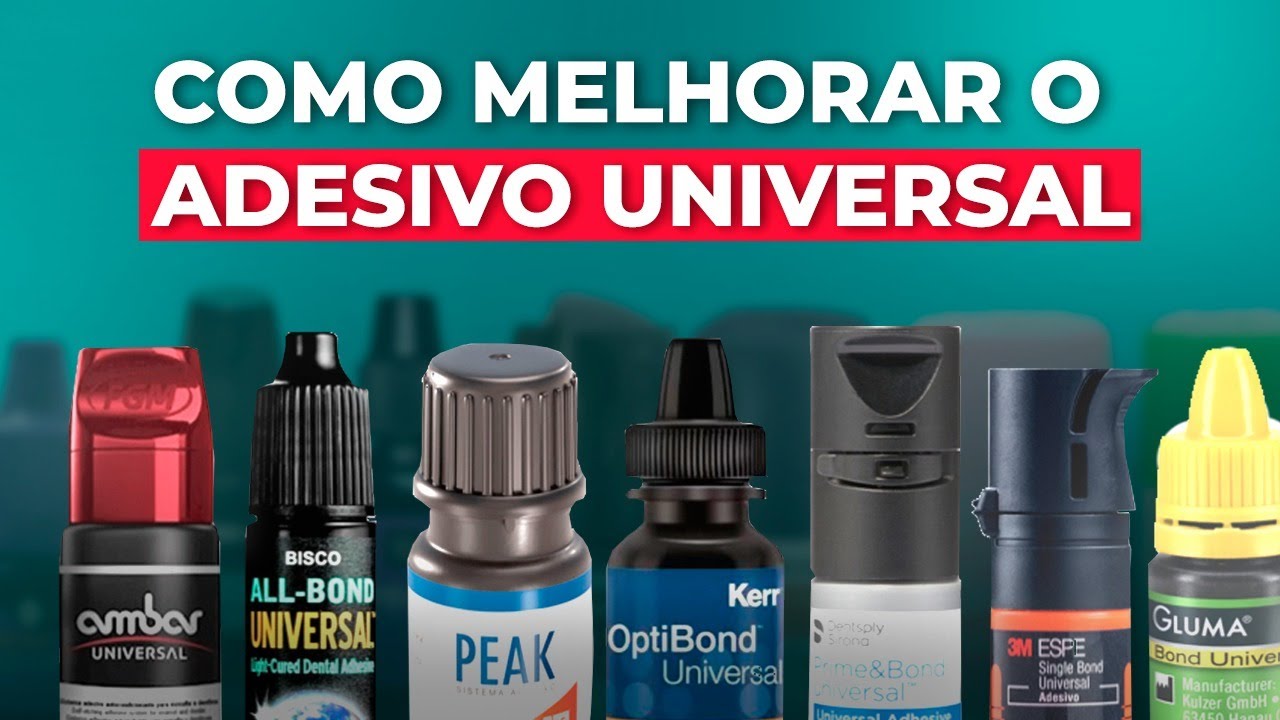 VALE A PENA? SISTEMA ADESIVO UNIVERSAL - Mylene e Renato