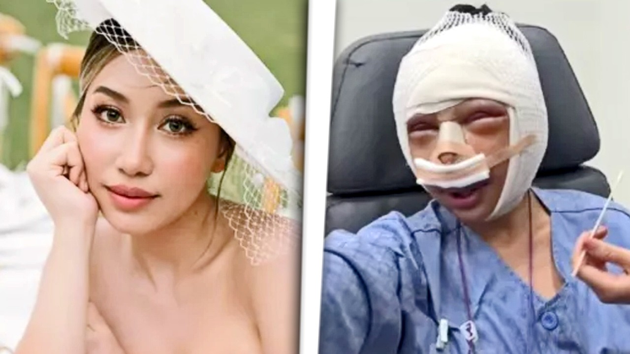 MUJER SE OPERA LA CARA ENTERA PARA SER TAN GUAPA COMO SU NOVIO MODELO - El caso viral de Pugun Wisad