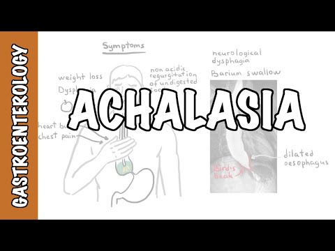 Acalasia (Esofágica) - Signos, Síntomas, Fisiopatología, Investigaciones y Tratamiento