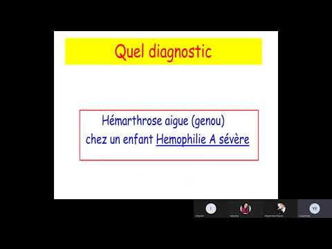 , title : 'Hémato  syndromes hémorragiques par anomalie de la coagulation'