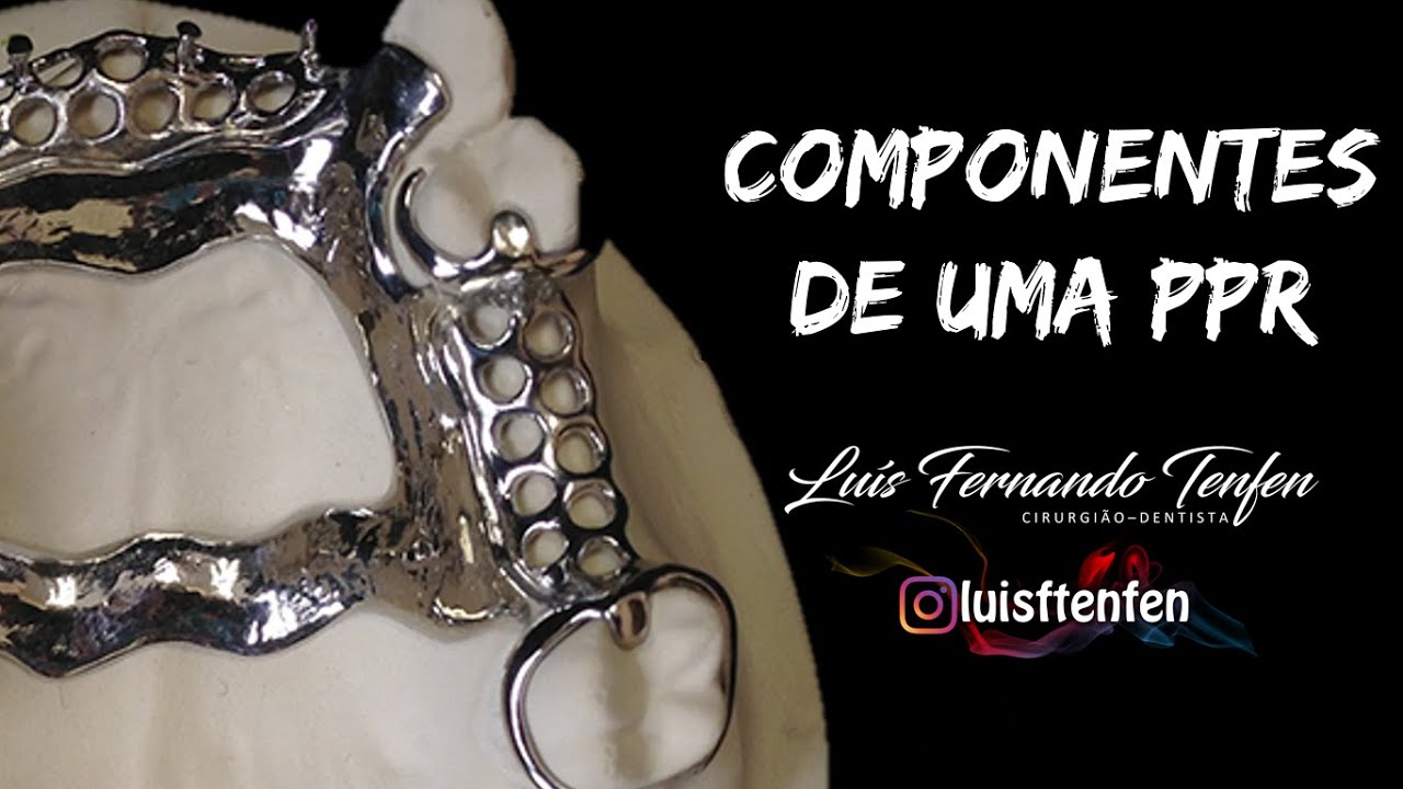 Prótese Parcial Removível #4: Componentes das PPRs