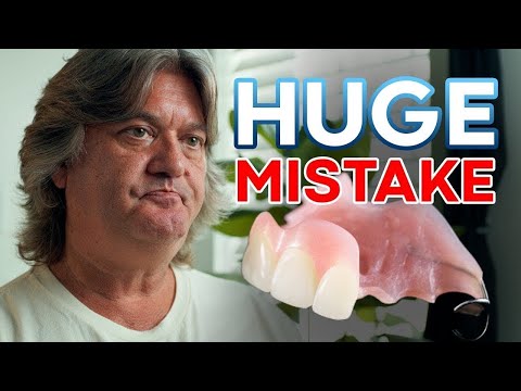 I Regret Getting Partial Dentures | Why You Should Avoid Them