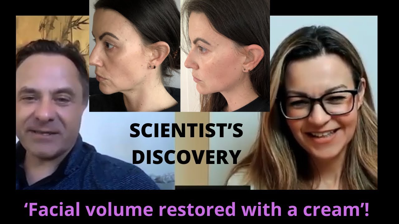 Facial fat loss and how to restore it naturally | Adipeau founder