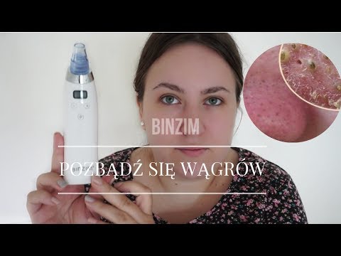 download lagu mp3 mp4 Odkurzacz Z Buzi, download lagu Odkurzacz Z Buzi gratis, unduh video klip Odkurzacz Z Buzi