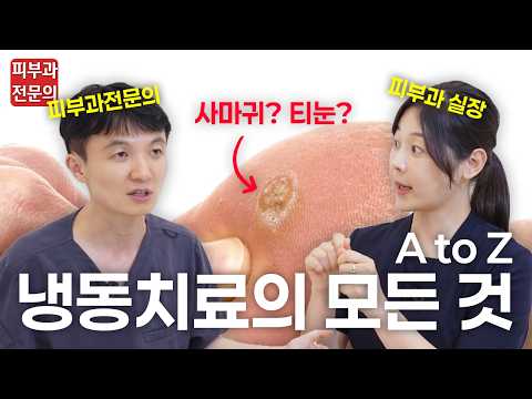 [냉동치료 A to Z] 냉동치료 방법부터 치료 후 주의사항까지!