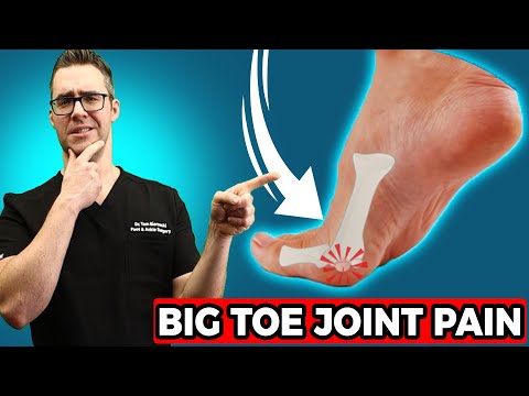 , title : 'BEST Sesamoiditis Treatment [Big Toe Joint Pain & Big Toe Treatment]'