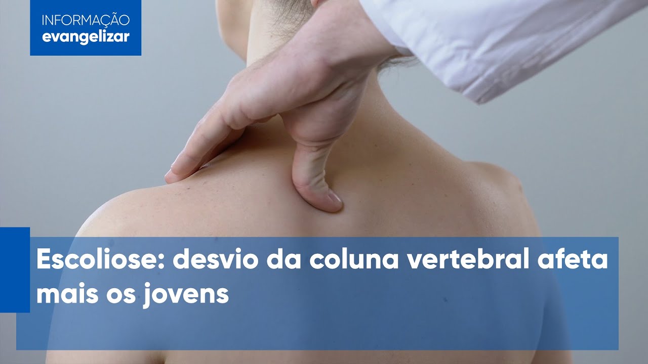 Álynson Larocca Kulcheski-100