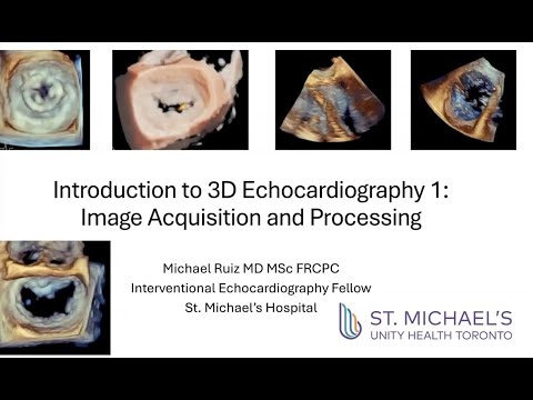 Introduction to 3D Echocardiography Part 1: Image Acquisition and Processing