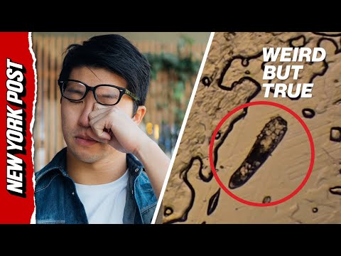 Gross eyelash mites live rent-free on your face — here's how to stop them | Weird But True