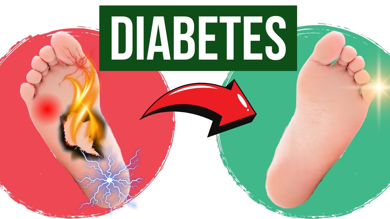 EXERCÍCIOS PARA NEUROPATIA DIABÉTICA