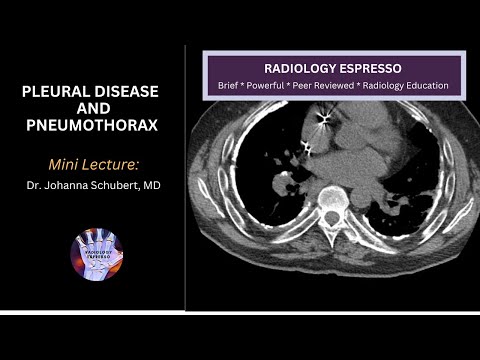 PLEURAL DISEASE AND PNEUMOTHORAX ON CHEST RADIOGRAPHS: Mini Lecture, Dr. Johanna Schubert, MD