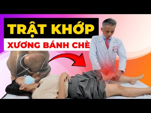 Trật Khớp Xương Bánh Chè: Đau Nhức Khó Đi Lại? Cách Chữa Dứt Điểm