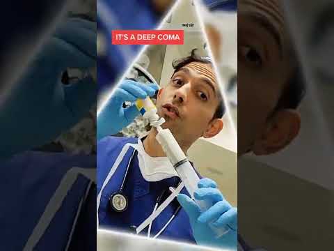 Anesthesia: Sleep or Coma?