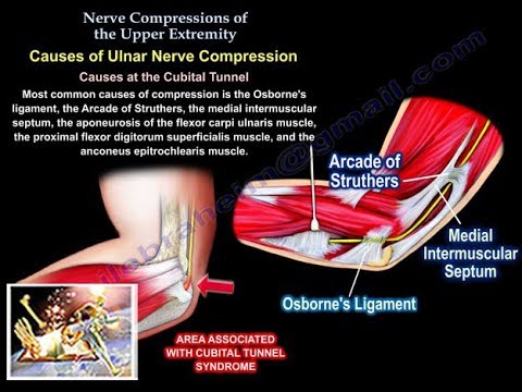 Nerve Compressions Of The Upper Extremity - Everything You Need To Know - Dr. Nabil Ebraheim