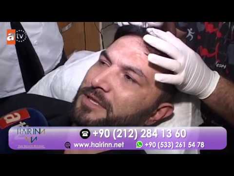 Hair Inn Sac Simulasyonu