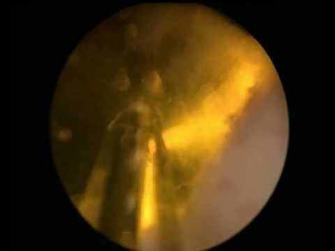 Kaufen in Kiew Prostamol Prostata-Analyse Zaun
