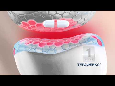 Disco grizha della colonna cervicale Osteosclerosi della colonna vertebrale cervicale