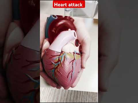 STERTILE DOBUTAMINE COCENTRATE IP