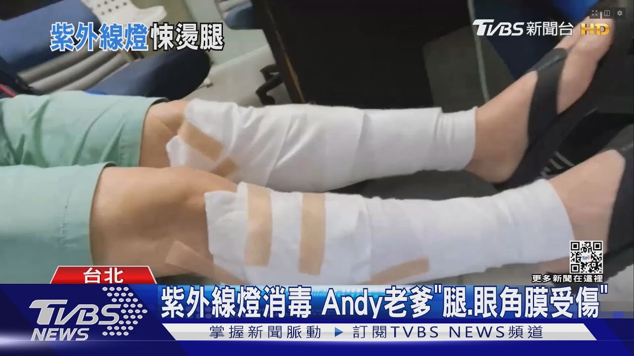 照紫外線燈1小時! 網紅Andy老爹「雙腿燙傷、眼角膜受傷」掛急診
